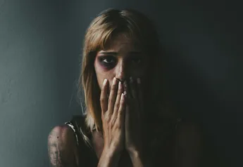 Beaten woman standing in front of a dark wall demonstrating violence on women.