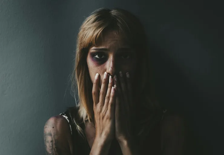 Beaten woman standing in front of a dark wall demonstrating violence on women.