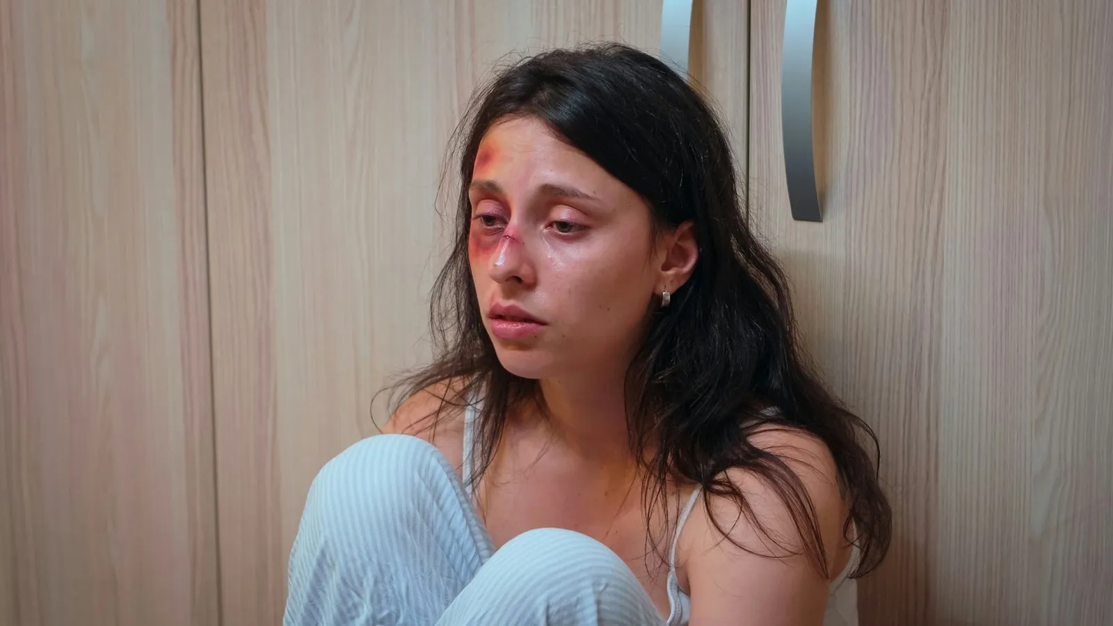 Close up of assaulted woman
